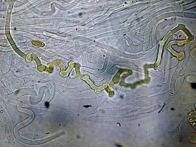 Xerocomus bubalinus   (Oolbekk. & Duin)  Redeuilh